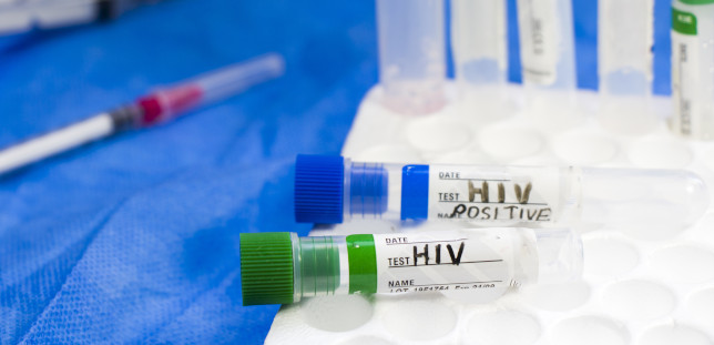 HIV Positiv nach Grippeimpfung